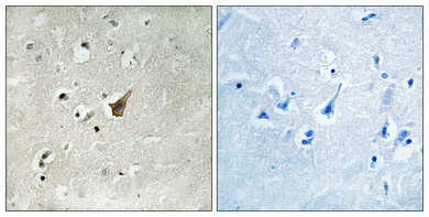 IHC - Mucin 1 (phospho Ser1227) Polyclonal Antibody AP68033